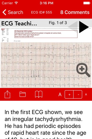 ECG Guru screenshot 2