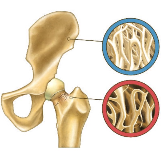 Osteoporosis Testing:Bone Health Guide and Age icon