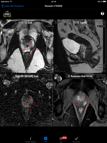 Prostate Cancer Imaging LITE screenshot 3