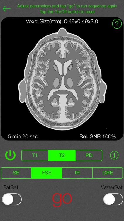 MRI Simulator