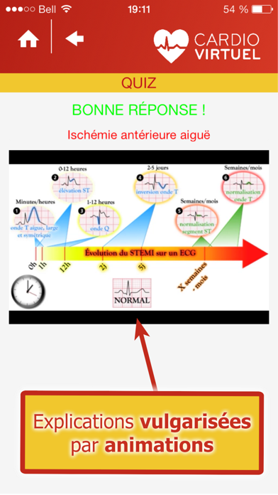 How to cancel & delete Cardio Virtuel présenté par des médecins spécialistes de l'Université Laval from iphone & ipad 3