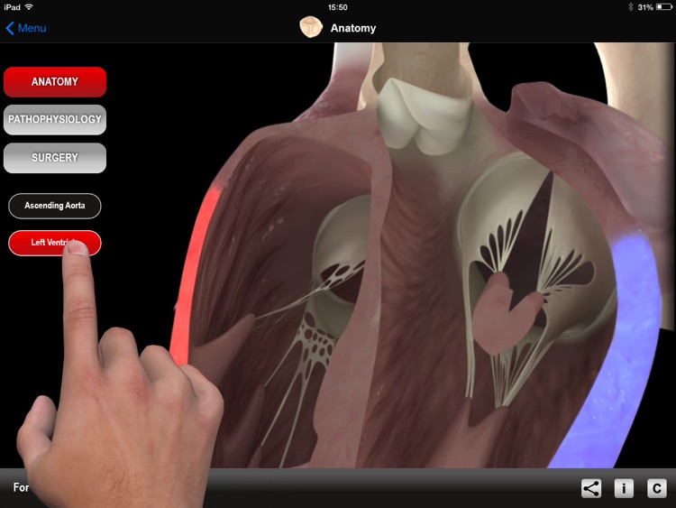 HEART MASTER Aortic Stenosis