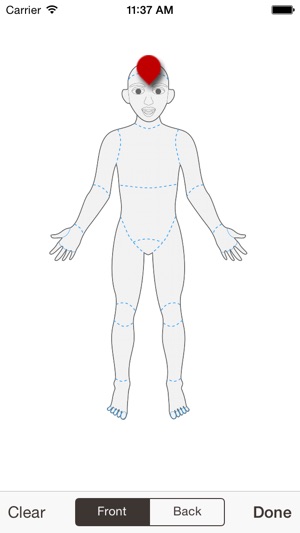 DigitalDermDr(圖2)-速報App