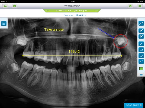 Dentstorm GO screenshot 3