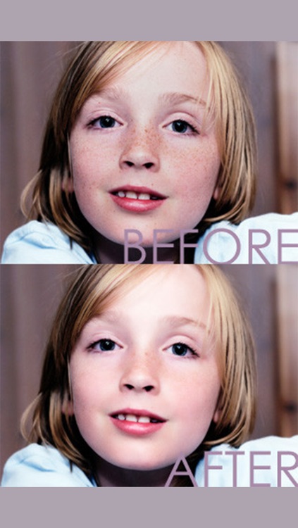moreBeaute2