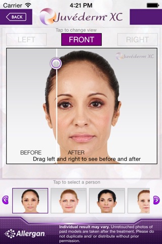 Rejuvenate - Before & After App screenshot 4