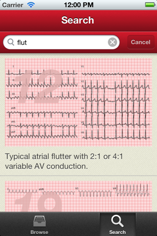 The ECG Collection screenshot 2