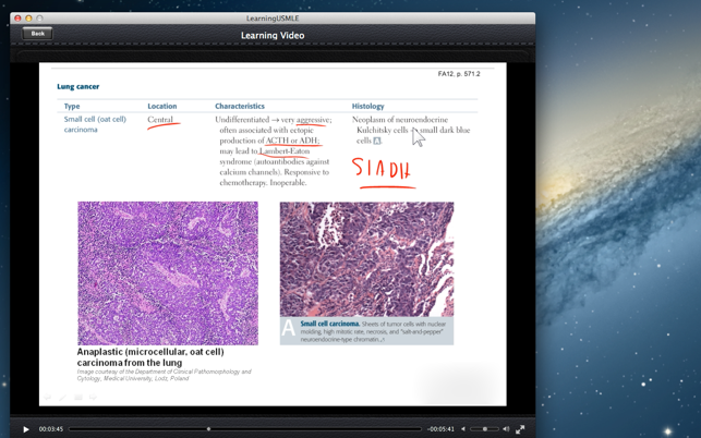 Learning USMLE(圖5)-速報App