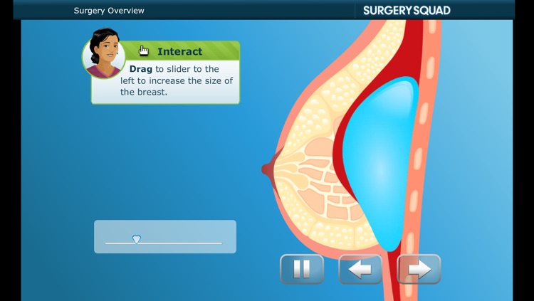 Virtual Breast Enhancement - Saline Implants - Surgery Squad