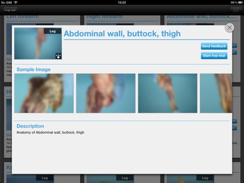 MeAV Anatomie screenshot 3