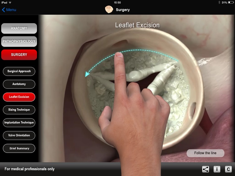 HEART MASTER Aortic Stenosis screenshot-4