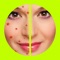 Tired of pimples/acnes