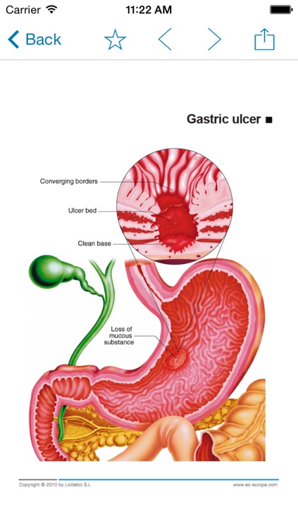Miniatlas Gastroenterology