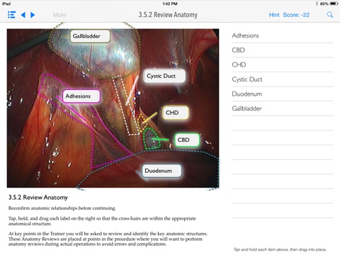SimPraxis Lap Cholecystectomy Trainer screenshot 3