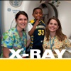 X-Ray: Imaging, here we go!