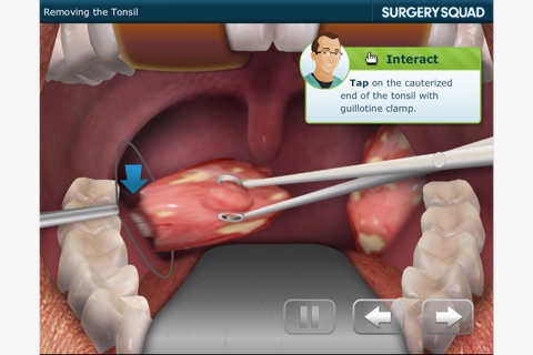 Surgery Squad's Virtual Tonsillectomy screenshot 4