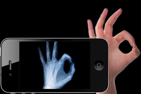 X ray for iPhone screenshot 2