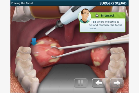 Surgery Squad's Virtual Tonsillectomy screenshot 3