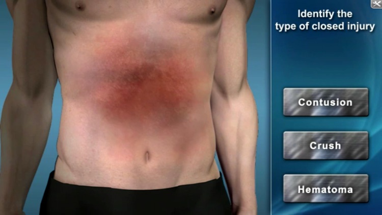 Medrills: Managing Soft-Tissue Trauma