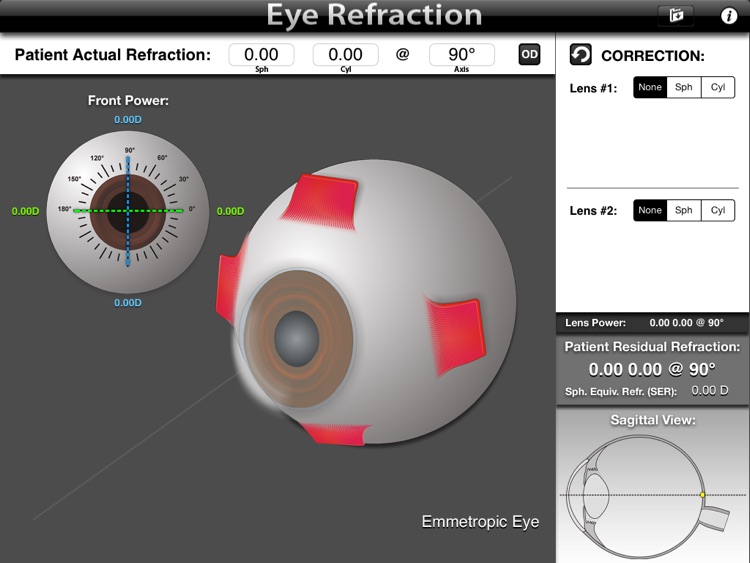 Eye Refraction