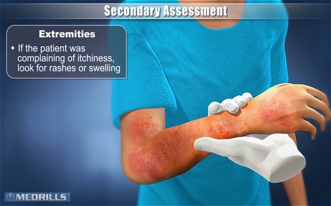 Medrills: Pediatric Assessments screenshot 4