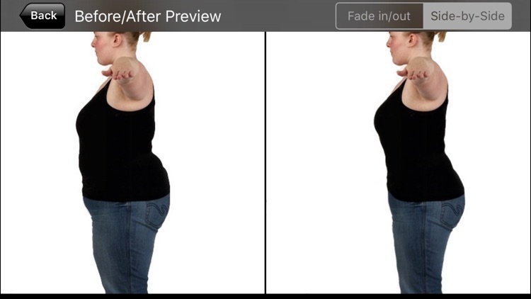 New Me by Blossom Bariatrics Surgery screenshot-3