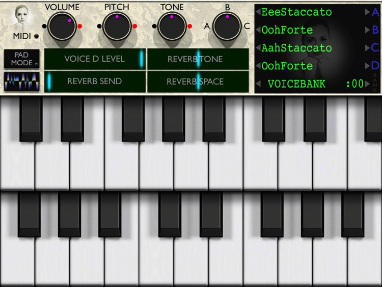 Sopranotron