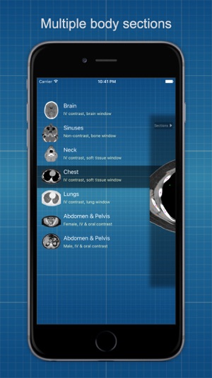 X-Anatomy Pro(圖4)-速報App