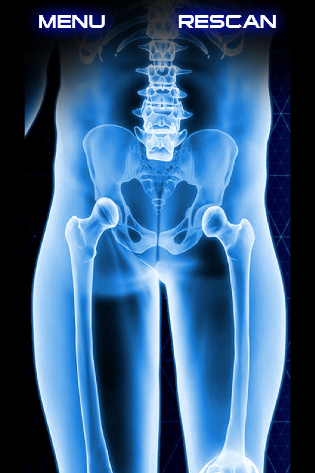 Xray Scanner Hip Bone Prank screenshot 2