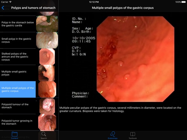 ENDO3®Atlas of GI Endoscopy HD(圖3)-速報App