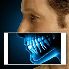 Activities of X-Ray Human Teeth Joke