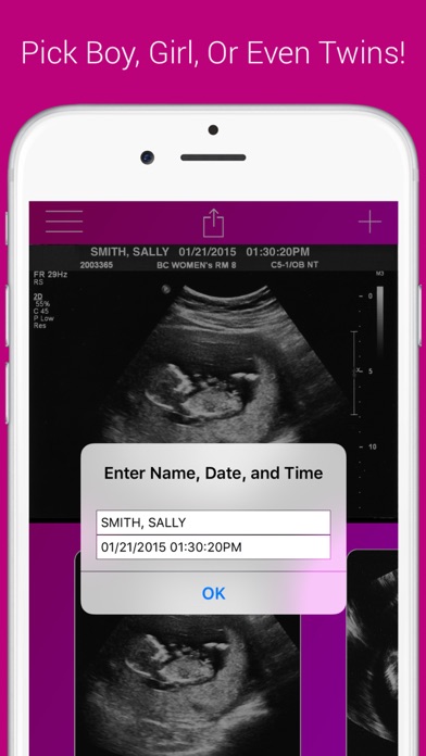 Ultrasound Prank Free - Pregnant Spoof And Fake Pregnancy Trick Screenshot on iOS