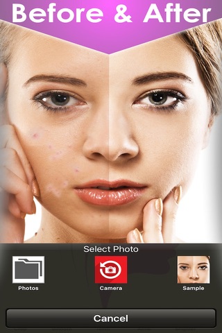 Beauty camera for perfect skin , acne eraser & wrinkles remover and blemish screenshot 3