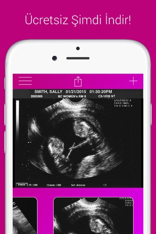 Ultrasound Prank Free - Pregnant Spoof And Fake Pregnancy Trick screenshot 4