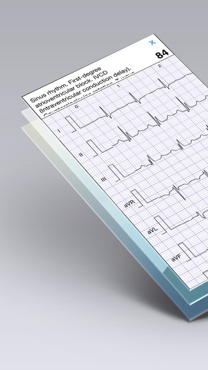 ECG Books Pro - Abnormal ECG (EKG) Case Database screenshot-3
