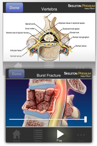 Skeleton Premium for Springer (Skelet Premie voor Springer) screenshot 3