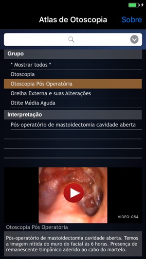 Atlas de Otoscopia(圖3)-速報App