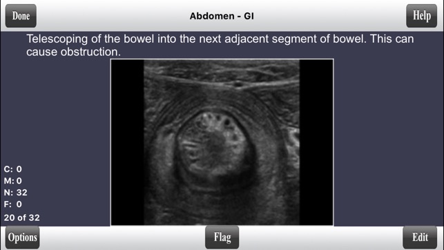 ARDMS Abdomen Ultrasound Flashcards for Boards(圖5)-速報App