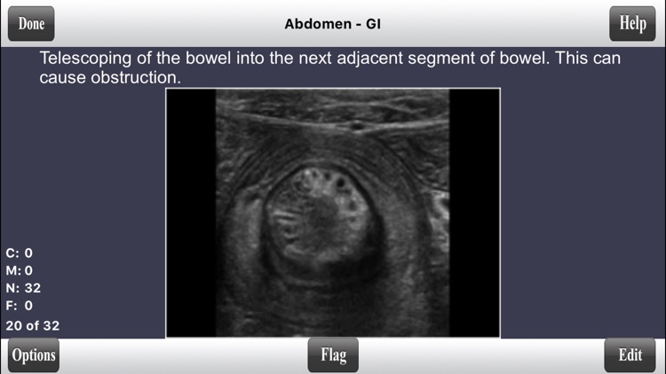 ARDMS Abdomen Ultrasound Flashcards for Boards screenshot-4