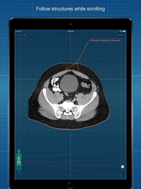 X-Anatomy Freeのおすすめ画像3