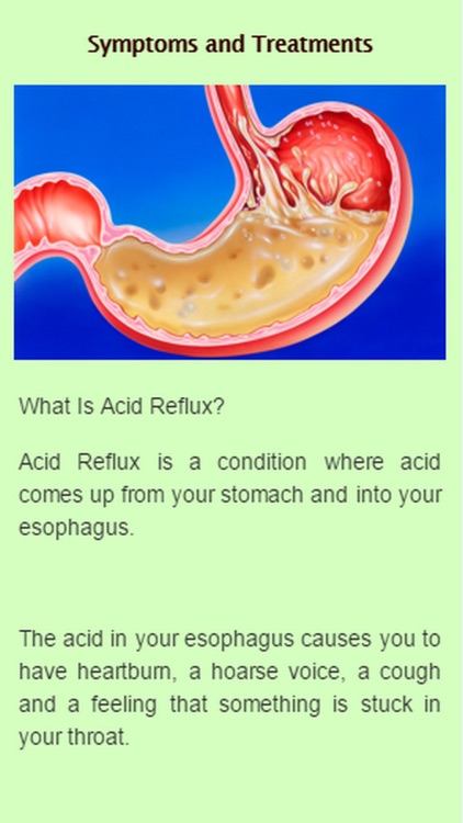 Acid Reflux Symptoms
