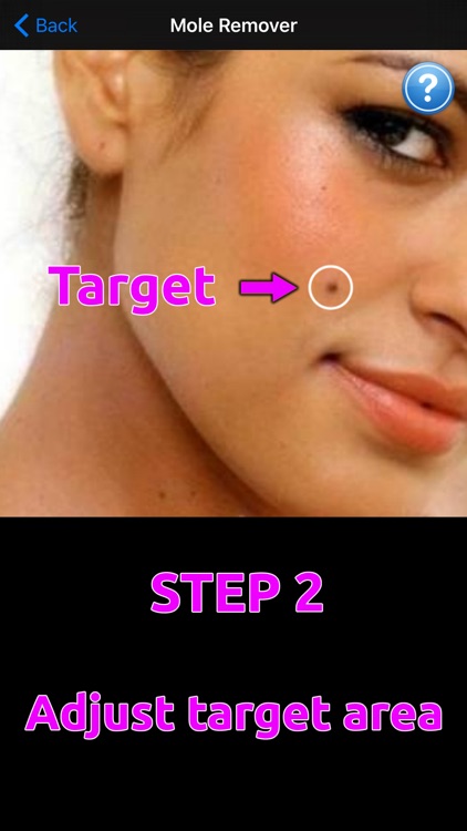 Mole Remover - Erase a blemish