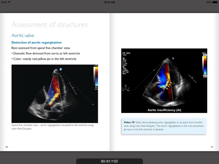 Ultrasound POC Education - Philips screenshot-3