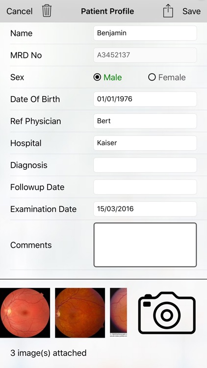 MII Ret Cam - Patient Profile