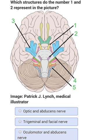 USMLE Neurology Review screenshot 2