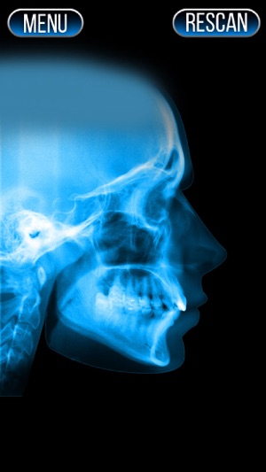 Xray Scanner Nose Prank(圖2)-速報App