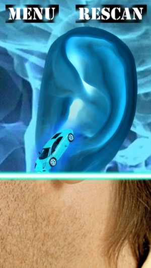 Xray Scanner Ear Prank(圖2)-速報App