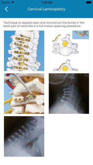 Motion Spine Institute(圖4)-速報App