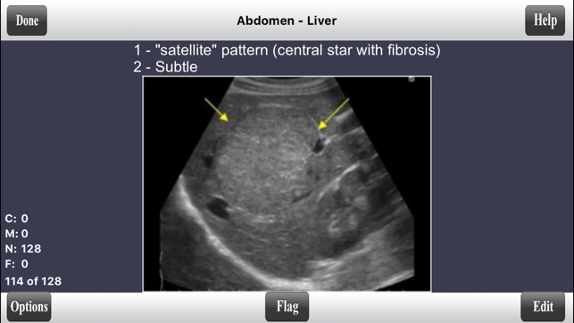 ARDMS Abdomen Ultrasound Flashcards for Boards(圖2)-速報App