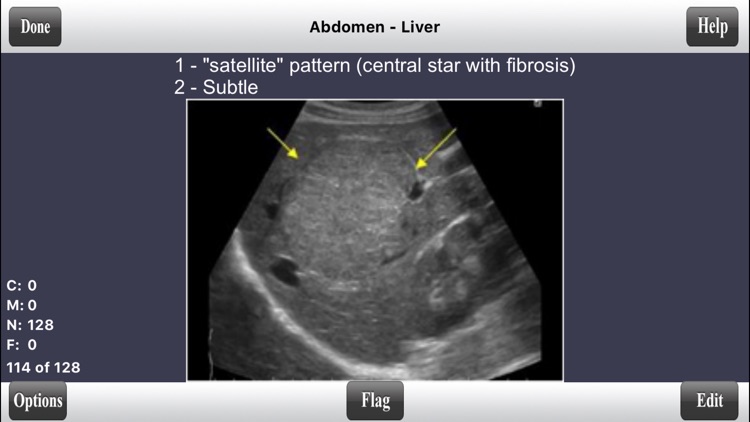 ARDMS Abdomen Ultrasound Flashcards for Boards